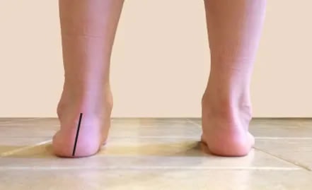 LittleSteps Foot Orthotics