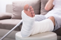 Treatments for a Broken Ankle