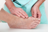 The Anatomy and Causes of Bunions