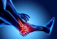 Arthritis Can Affect the Feet, Toes, and Ankles